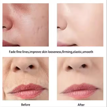 Korean Anti-Wrinkling Moisturizing Face Cream