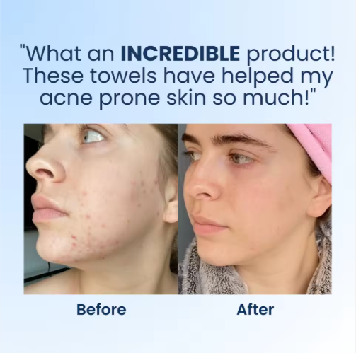 Disposable Eco-Friendly Clinically Tested Face Towels